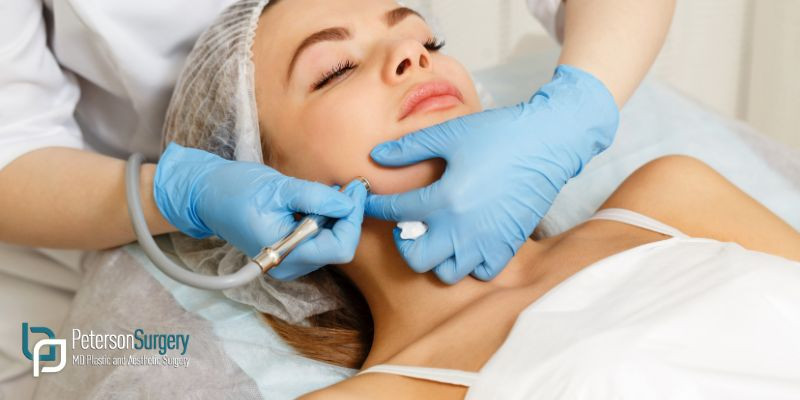 DERMABRASION VS MICRODERMABRASION: UNDERSTANDING THE DIFFERENCE – KELOWNA DERMABRASION DERMABRASION VS MICRODERMABRASION: UNDERSTANDING THE DIFFERENCE – KELOWNA DERMABRASION